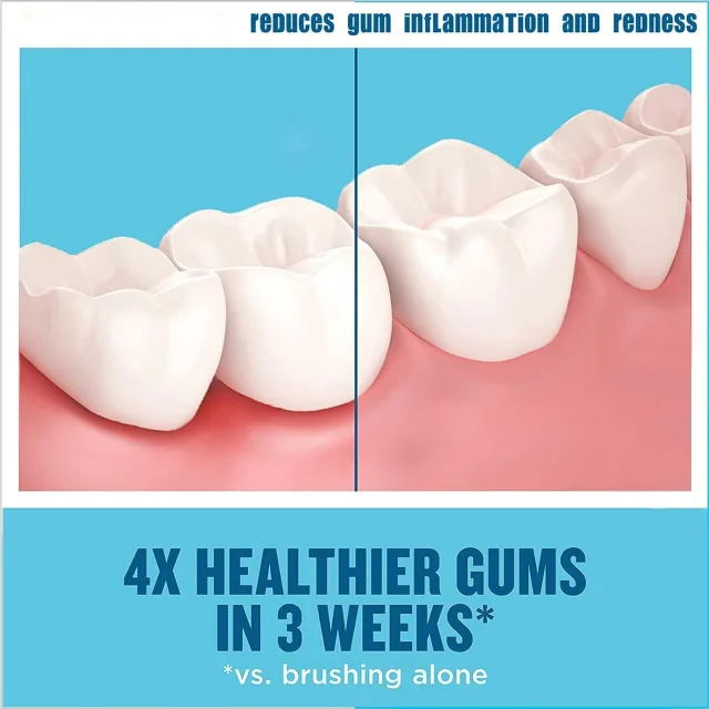 Mouthwash Foam, Mouthwash Whitening Toothpaste Foam, Calculus Removal, Teeth Whitening (4PCS) Gallery image 5