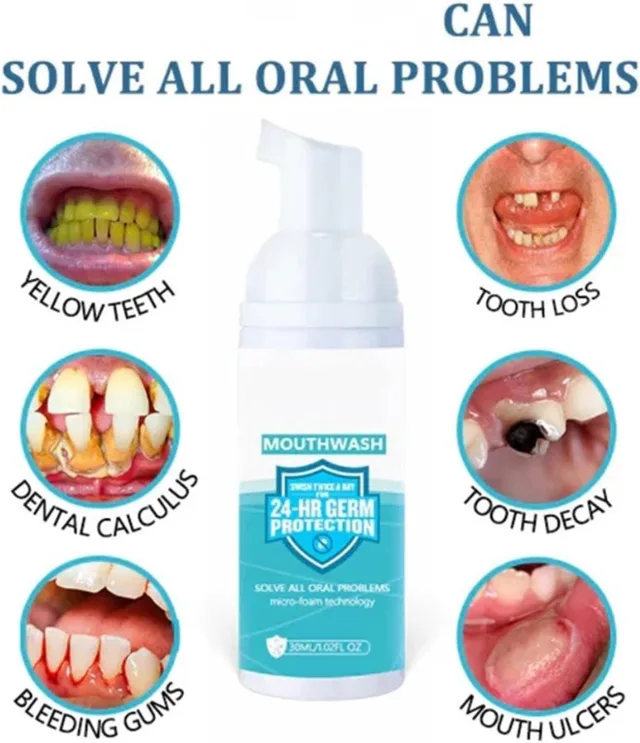 Mouthwash Foam, Mouthwash Whitening Toothpaste Foam, Calculus Removal, Teeth Whitening (4PCS) Gallery image 4